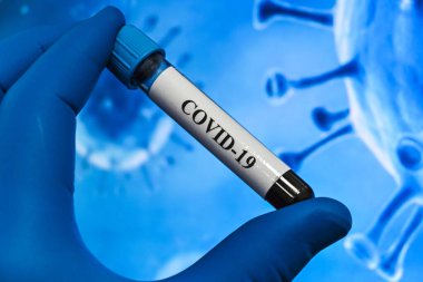 COVID-19 üzerinde test ediliyor. Coronavirus SARS-CoV-2 tespiti için bir tüp kan..