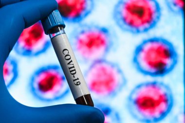 COVID-19 üzerinde test ediliyor. Coronavirus SARS-CoV-2 tespiti için bir tüp kan..