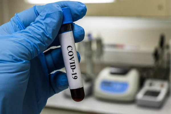 Проверка Covid Трубка Крови Обнаружения Коронавируса Sars Cov — стоковое фото