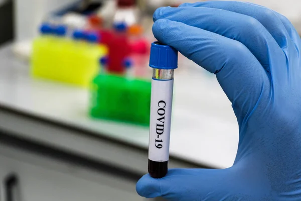 Pruebas Covid Tubo Sangre Para Detección Del Coronavirus Sars Cov —  Fotos de Stock