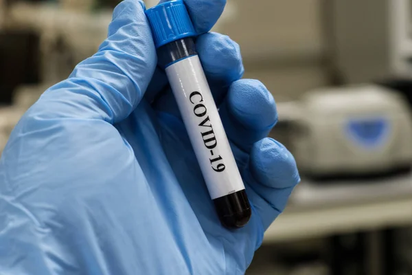Проверка Covid Трубка Крови Обнаружения Коронавируса Sars Cov — стоковое фото