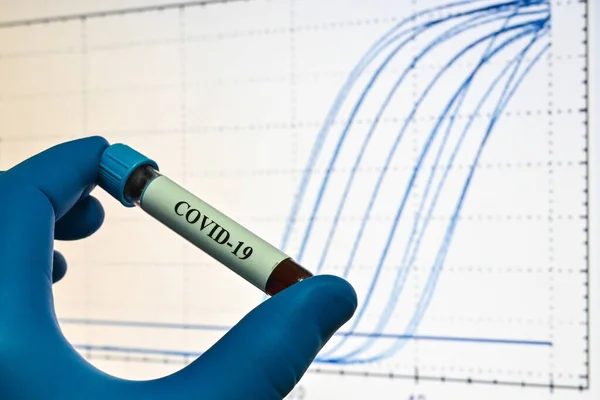 Coronavirus Sars Cov Pcr Kimutatása Vérminta Covid Vizsgálatához — Stock Fotó