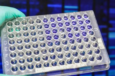 Laboratuvar DNA testi. Elektroforez görüntüsünün arka planında 96 kuyu plakası var..