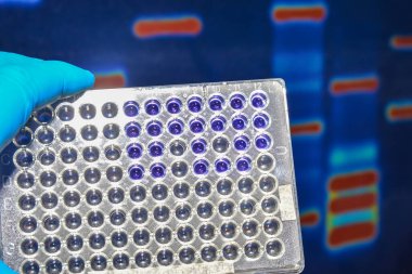 Laboratuvar DNA testi. Elektroforez görüntüsünün arka planında 96 kuyu plakası var..