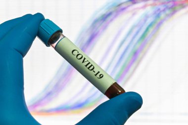 PCR teşhisi COVID 19. REAL-TIME PCR amplifikasyon eğrilerinin arka planına karşı numune içeren bir test tüpü.