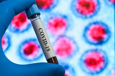 Coronavirus testi. COVID-19 teşhisi için numune içeren test tüpü.