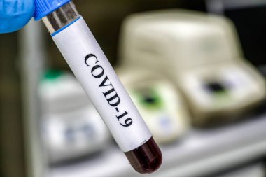 Coronavirus testi. COVID-19 teşhisi için numune içeren test tüpü.