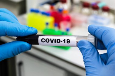 Coronavirus testi. COVID-19 teşhisi için numune içeren test tüpü.