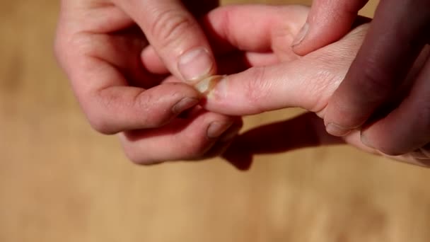 Poškozené nehty na ženské ruce — Stock video