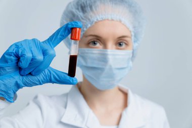 Doktor Coronavirus testi için kan örneğiyle birlikte test tüpü tutuyor. Solunum Sendromu, Wuhan, Çin. 2019-ncov.