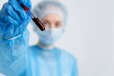 Test tube with blood sample in nurse's hand.