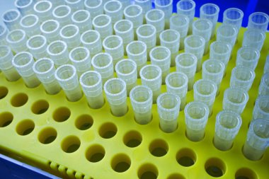 Mikro pipet için sarı plastik askıda bulunan Eppendorf tüpü: 0.1 ml    