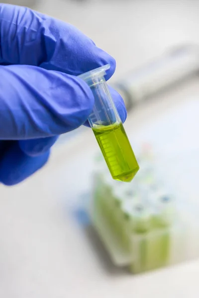 Κοντινό μέχρι τα χέρια σε μπλε γάντια κρατήστε το microtube με πράσινο υγρό εκχύλισμα. Σύνθεση νέου εμβολίου ή φαρμάκου κατά του ιού. — Φωτογραφία Αρχείου