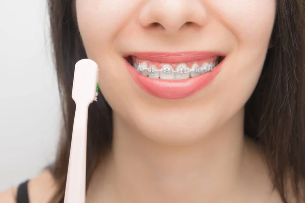 Limpar Dentes Com Aparelho Dentário Por Escova Rosa Mulher Feliz — Fotografia de Stock