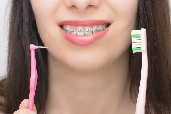 两种刷牙用的刷子 美白后牙齿上的支架 带有金属领带和灰色弹力或橡皮筋的自联括号 以获得完美的微笑 牙齿矫正治疗 — 图库照片