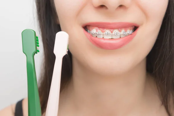 Czyszczenie Zębów Aparatem Dentystycznym Pomocą Szczotek Szczęśliwa Kobieta Nawiasami Zębach — Zdjęcie stockowe