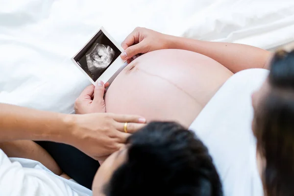 Gravid Kvinna Och Hennes Hasband Tittar Ultraljudsfilmen Tillsammans Begreppet Lycklig — Stockfoto