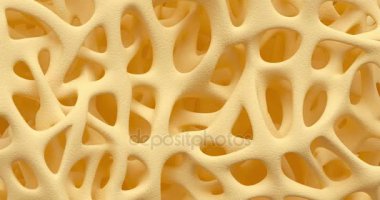 Kemik Osteoporoz animasyon
