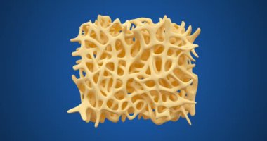 Kemik Osteoporoz animasyon