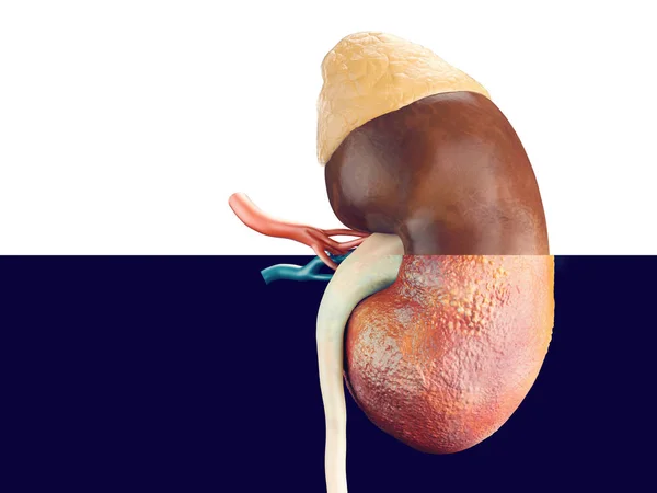 Человеческая почка наполовину больна — стоковое фото