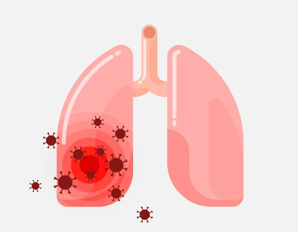 Menselijke longen geïnfecteerd door het virus — Stockvector