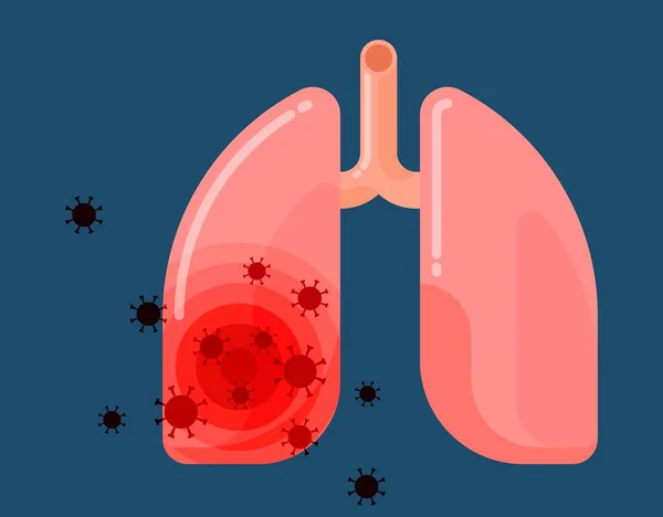 Легкие человека заражены вирусом на синем фоне — стоковый вектор