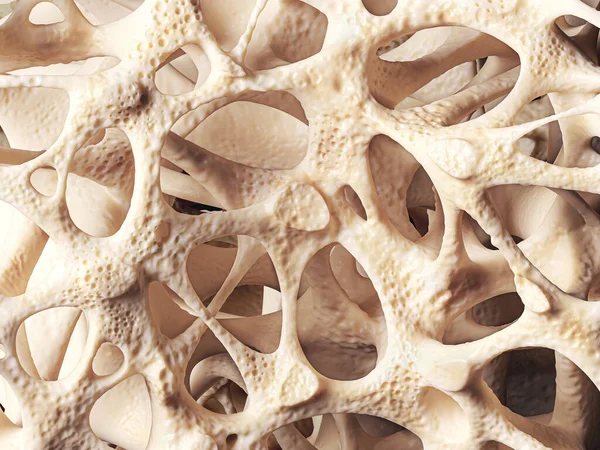 Struttura ossea con osteoporosi — Foto Stock