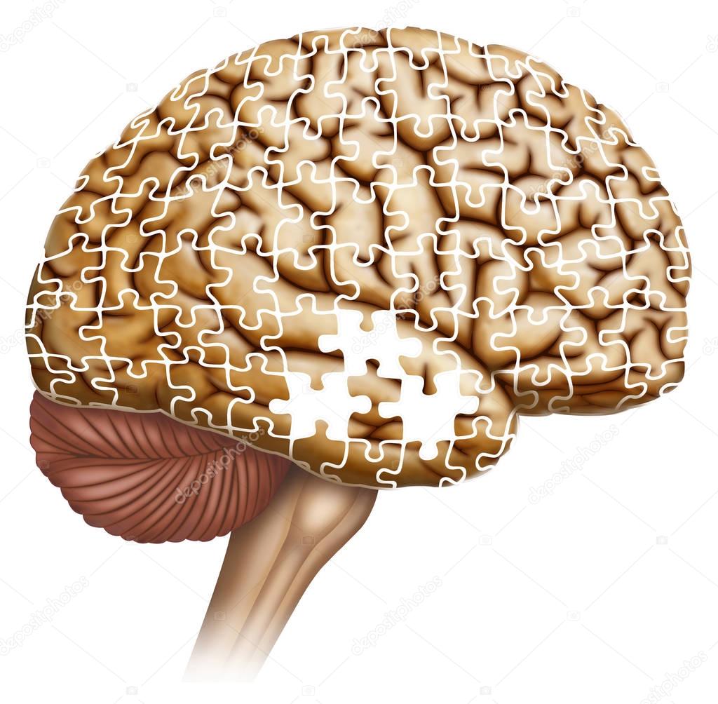 Cerebral manifestations in Alzheimer