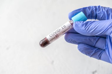 COVID-19 testi için kan örneğiyle birlikte test tüpü. Pozitif test.