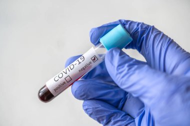 COVID-19 testi için kan örneğiyle birlikte test tüpü. Negatif test.