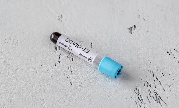 Test Tube Blood Sample Covid Test Negative Test — Stock Photo, Image
