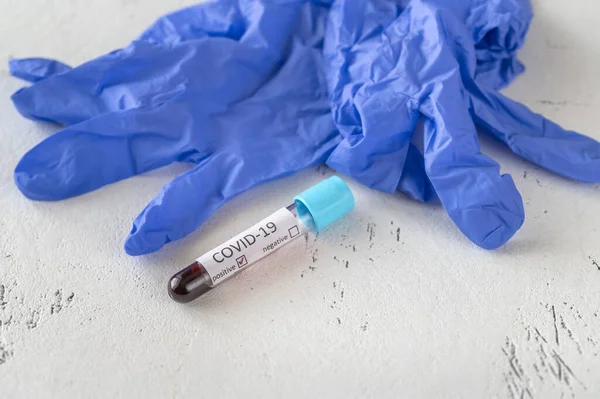 Test Tube Blood Sample Covid Test Positive Test — Stock Photo, Image