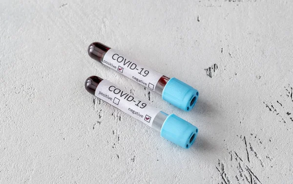 Test Tube Blood Sample Covid Test — Stock Photo, Image