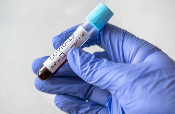 Test Tube Blood Sample Covid Test Negative Test — Stock Photo, Image