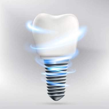 Simge insan diş implantı. Hisse senedi illüstrasyon.
