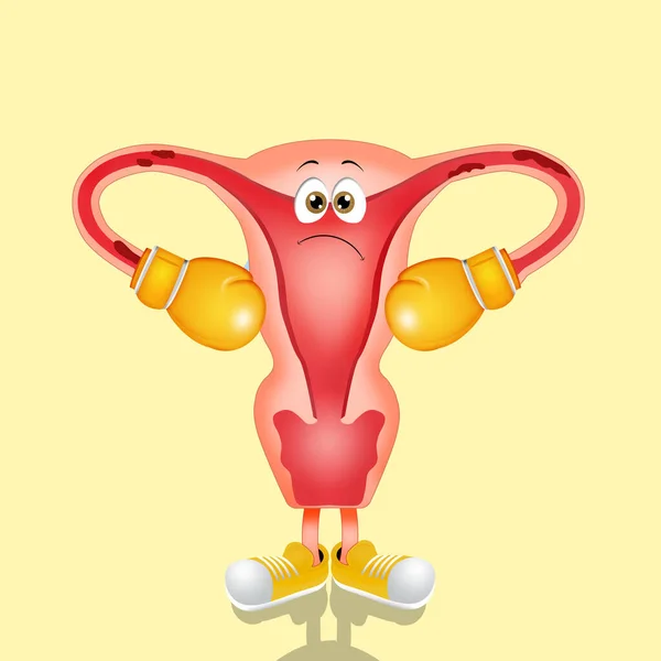 Illustraiton Endometrios Med Boxningshandskar — Stockfoto