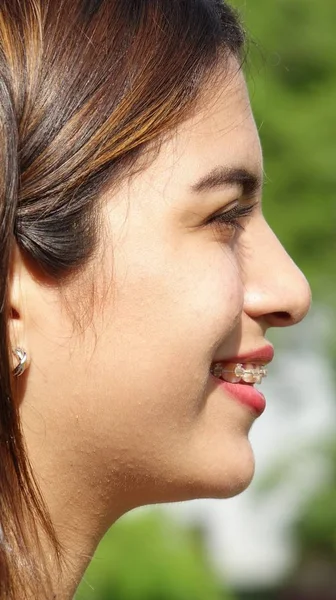 Mädchen lächelt mit Zahnspange — Stockfoto