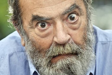 Demans ve sakallı yaşlı kişi