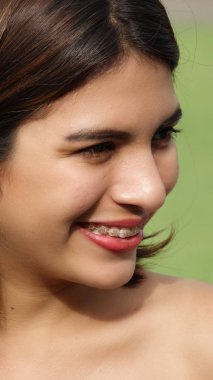 Diş telleri olan Perulu dişi