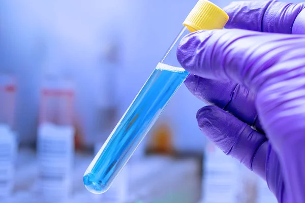 Bacteria test on laboratory test tube — Stock Photo, Image