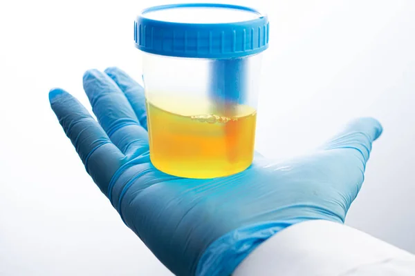 Urine analysis in the laboratory. Medical urine test. — Stock Photo, Image