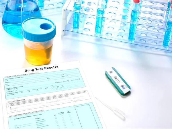 A detecção de drogas na urina — Fotografia de Stock