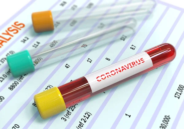 Exame de sangue de coronavírus em laboratório hospitalar — Fotografia de Stock