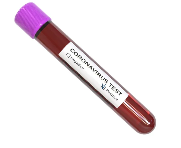 Test tube of Coronavirus Blood tests — 스톡 사진