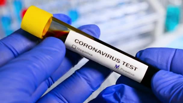 Hastane Laboratuvarında Coronavirus Kan Testi — Stok video