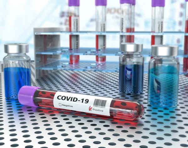Coronavirus Covid Análisis Sangre Laboratorio Del Hospital — Foto de Stock