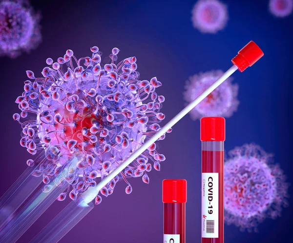 Απόδειξη Επιχρισμάτων Λαιμού Για Τον Coronavirus Covid Θετική Ανάλυση Αίματος — Φωτογραφία Αρχείου