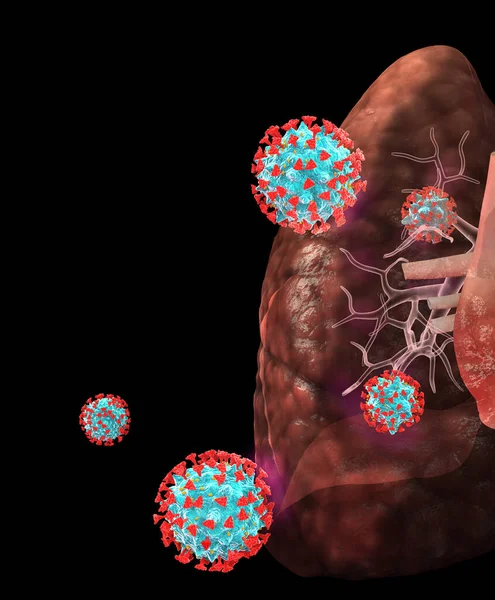 Coronavirus Covid Wabah Infeksi Menular Menyerang Paru Paru — Stok Foto