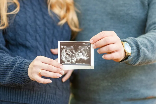Esposa y esposo sostienen imagen de ultrasonido del bebé en el útero —  Fotos de Stock