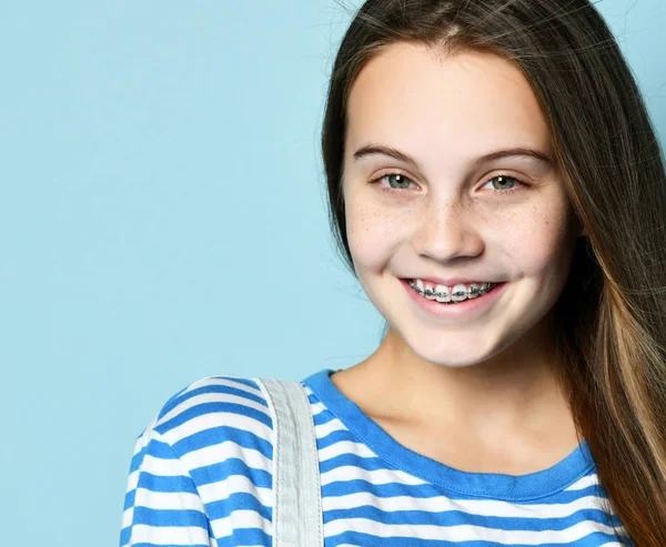 Rostro de una joven con frenos en los dientes — Foto de Stock